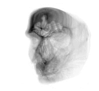 Animated CT image of a 3D-reconstruction of a human head